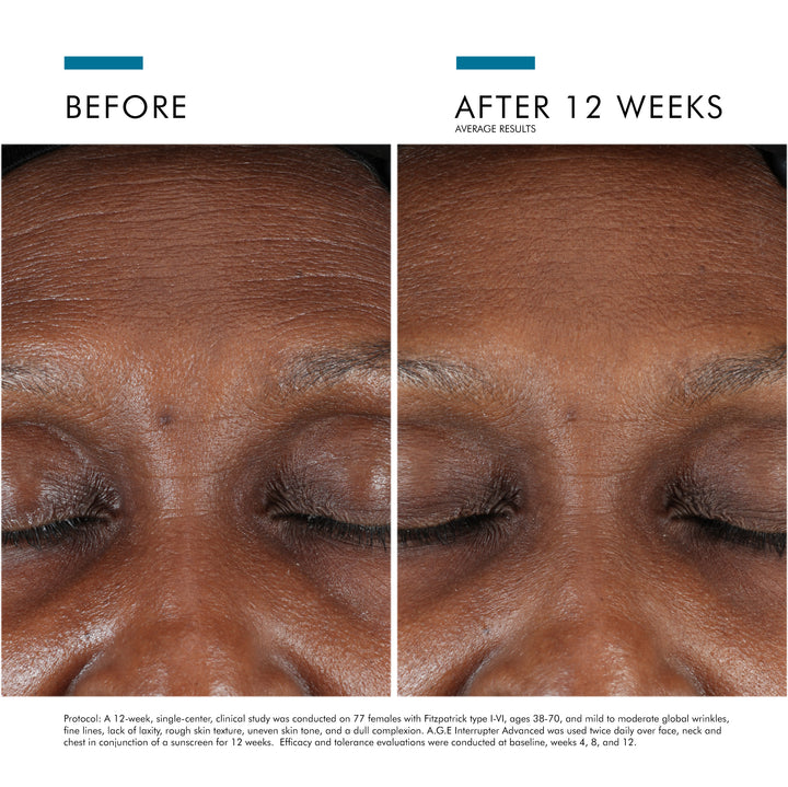 Crème anti-âge A.G.E. Interrupter Advanced 15ml