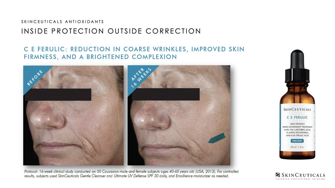 CE Ferulic 30ml