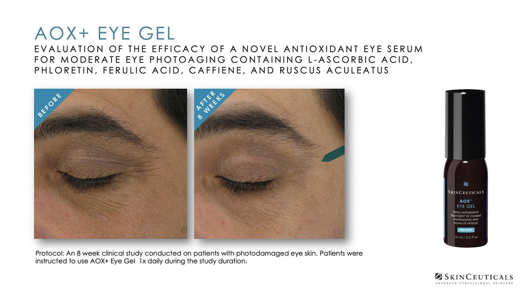 AOX Eye Gel
