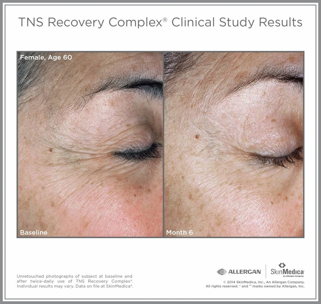 TNS Recovery Complex® 28.4 g / 1 oz