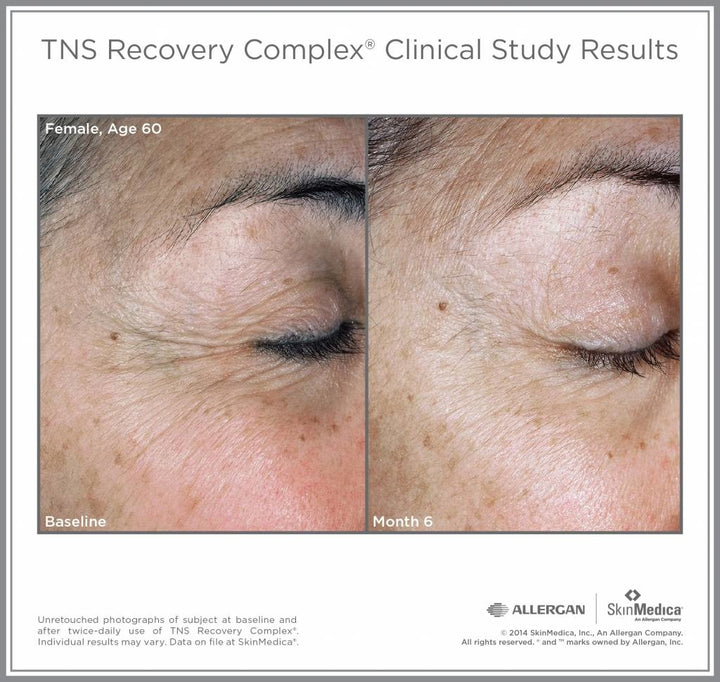 TNS Recovery Complex® 28.4 g / 1 oz