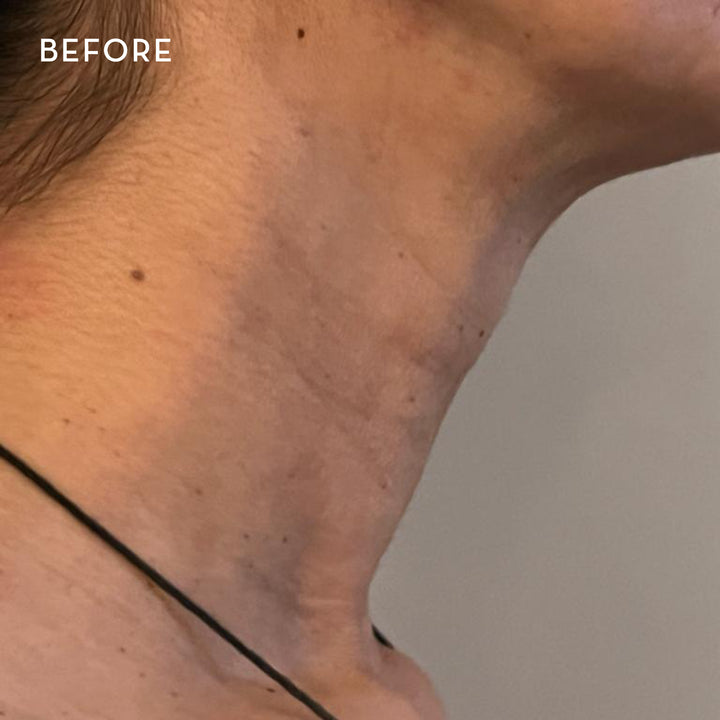 Boost LED Collar pour le cou et le visage