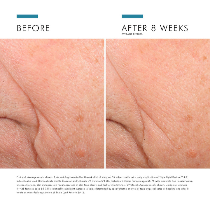 Triple Lipid Restore 2:4:2 - 48ml