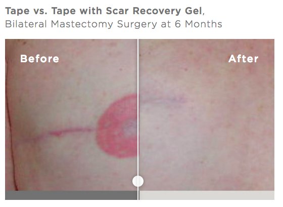 Scar Recovery Gel with Centelline 14.2g