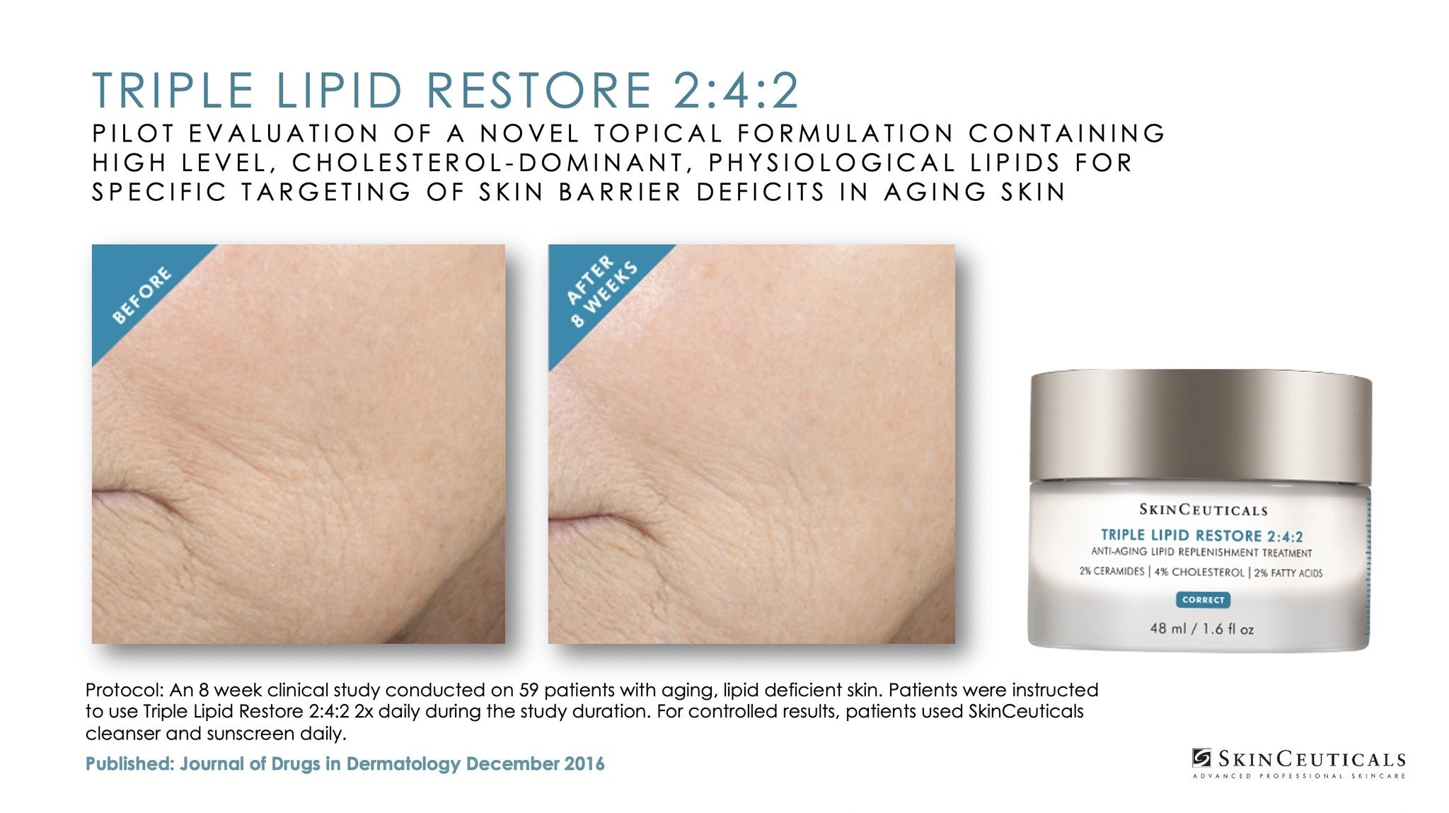 SkinCeuticals Triple Lipid Restore 2 :4 :2 48ml/1.6 fl. hotsell oz.