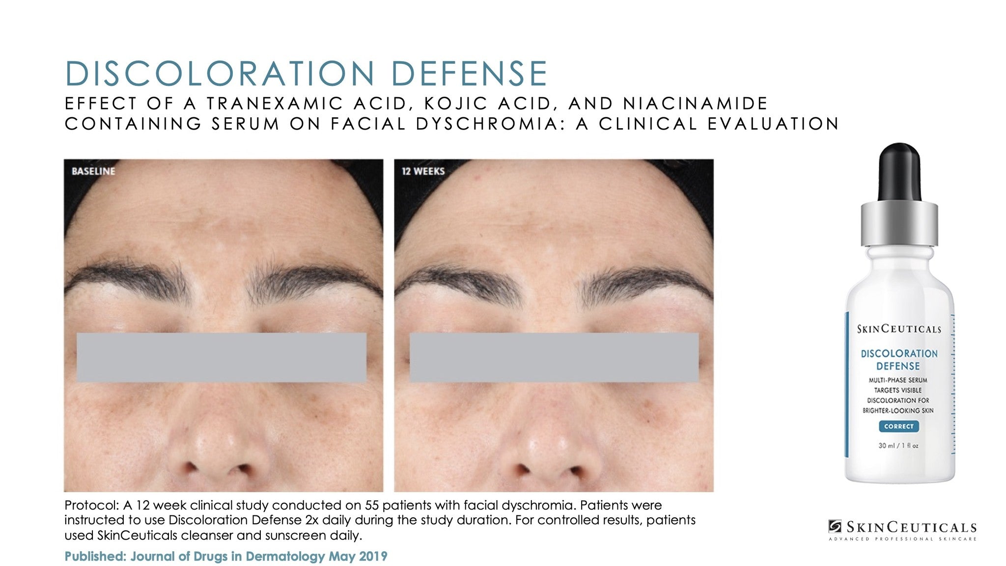 SkinCeuticals hot discoloration defense